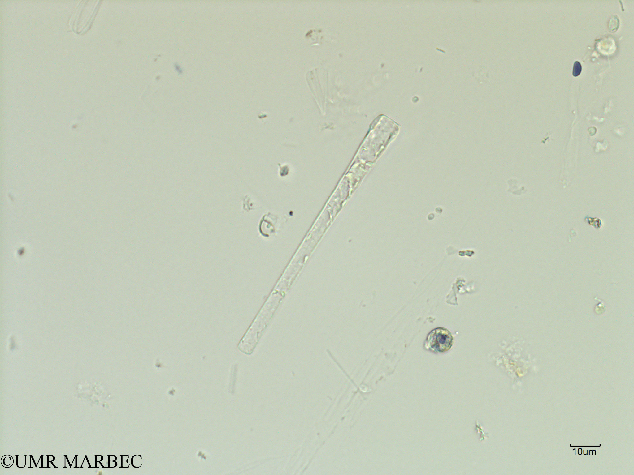 phyto/Scattered_Islands/iles_glorieuses/SIREME May 2016/Asterionella bleakeleyi var. notata (SIREME-Glorieuses2016-GLO5surf-121016-diatomée-4)(copy).jpg